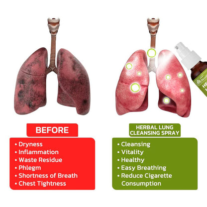 Herbal Lung Spray